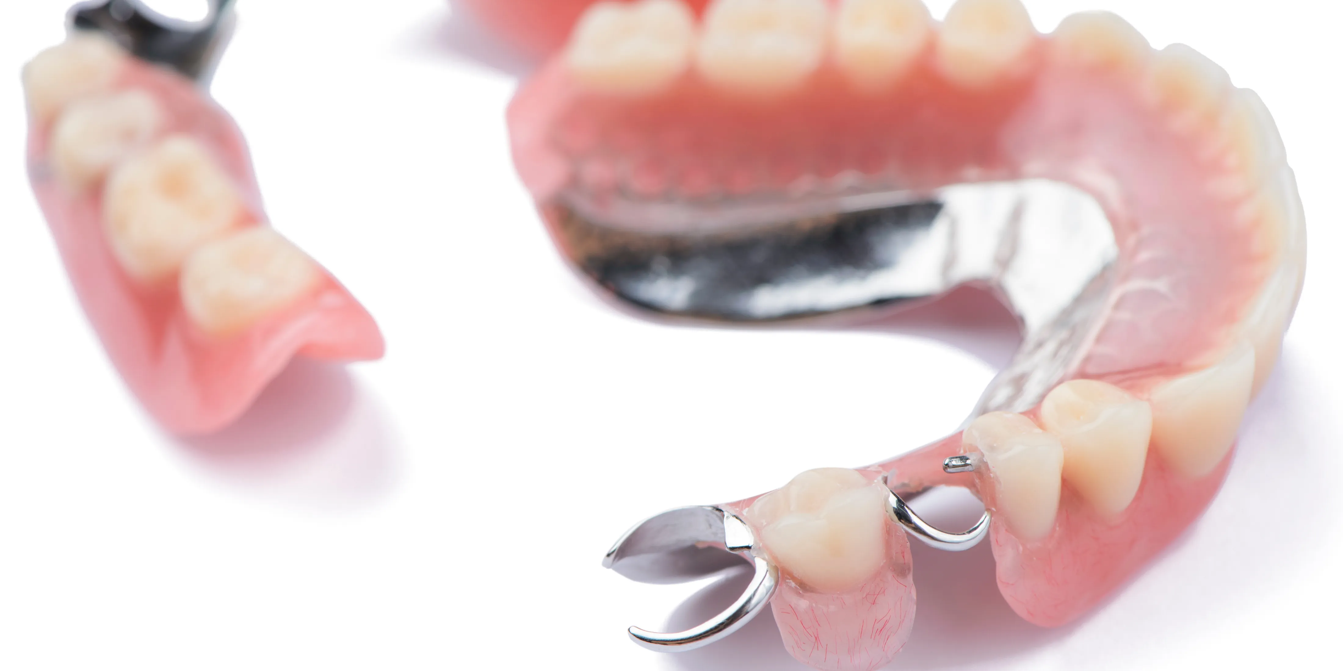 部分入れ歯と総入れ歯｜構造と特徴の違いについて