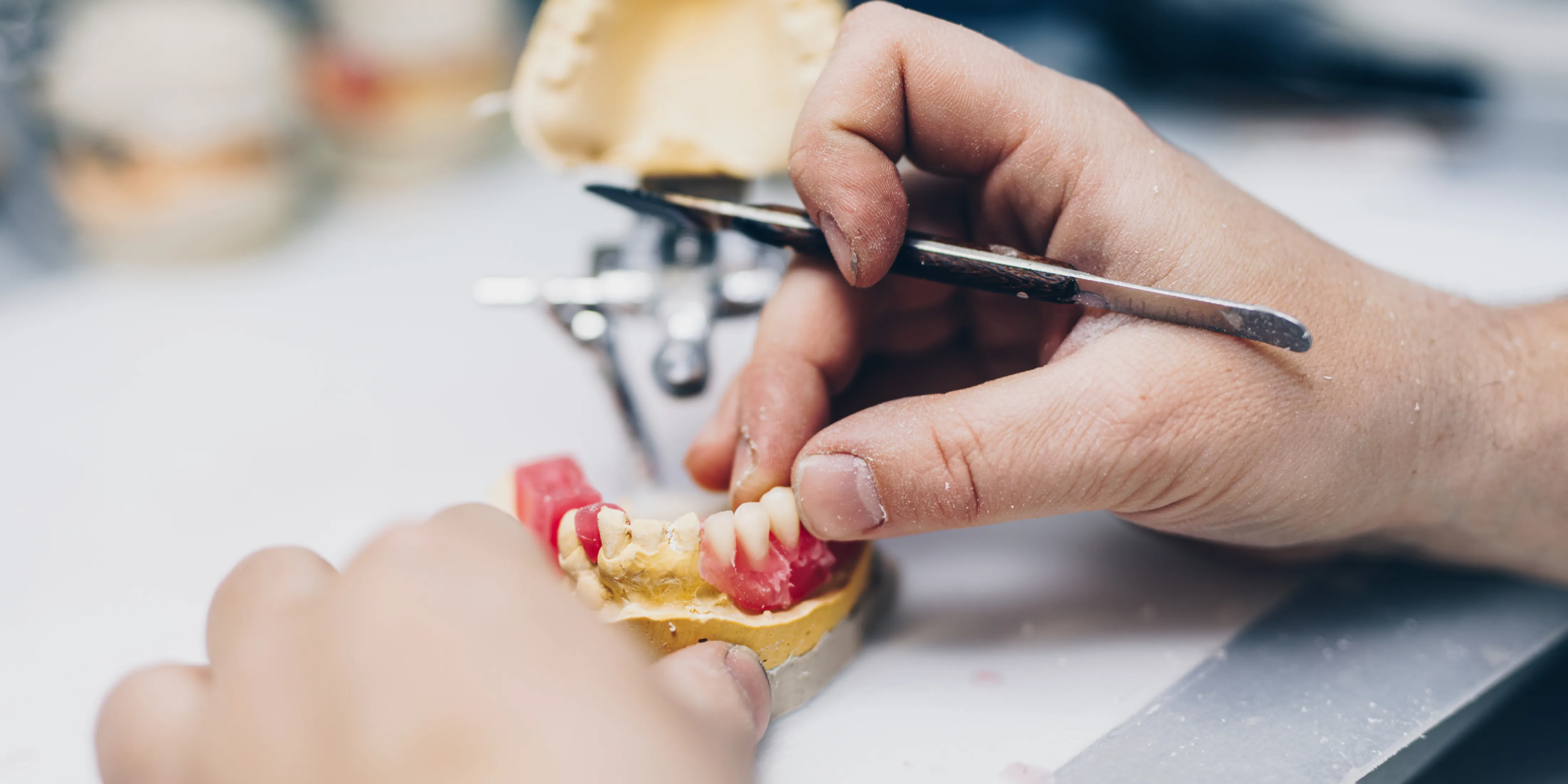 オーダーメイド義歯