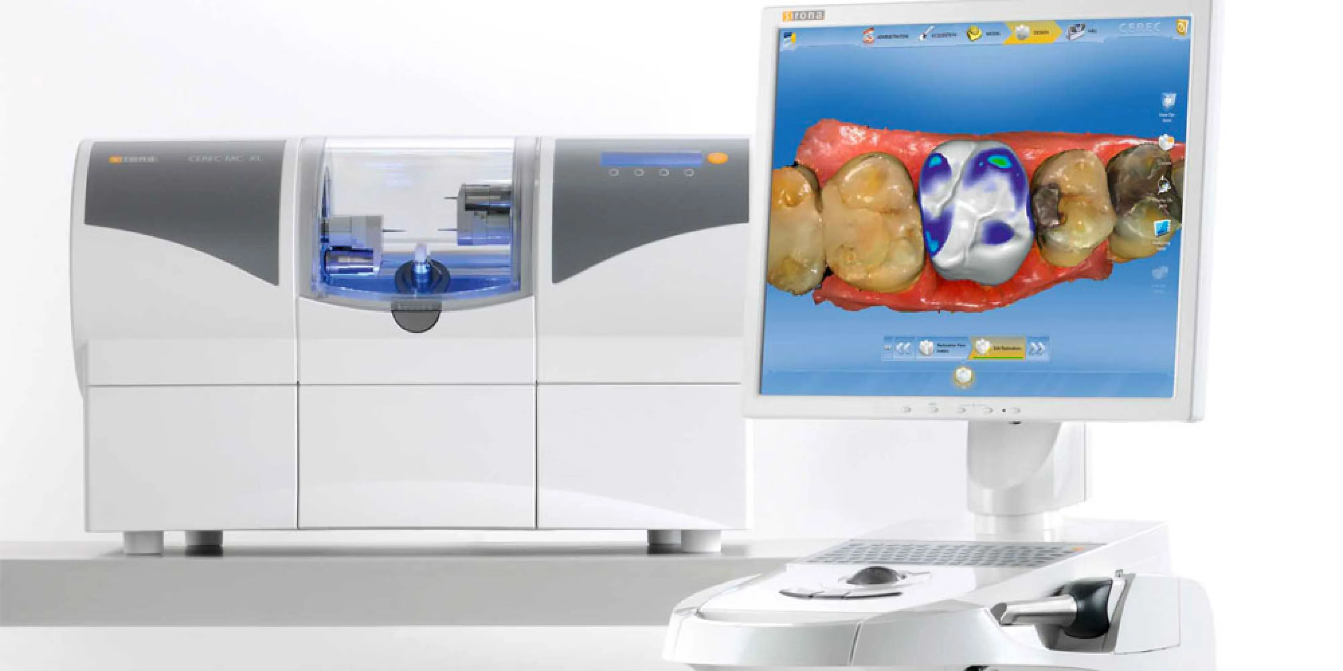 セレックシステム