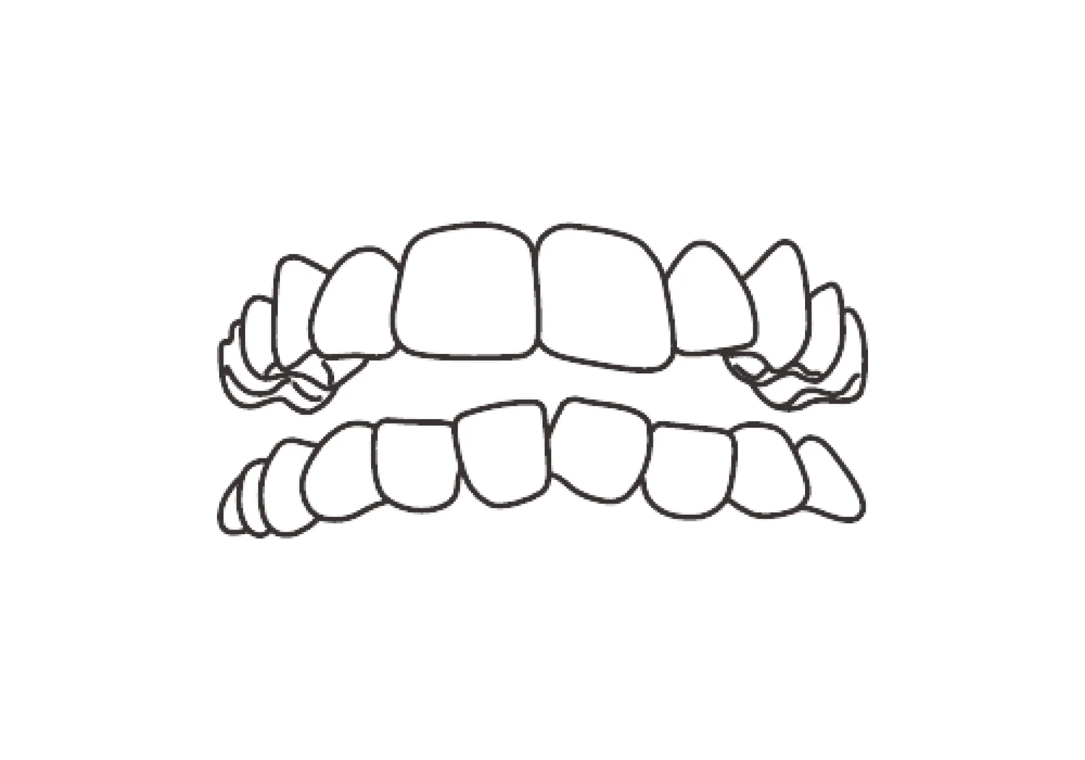 叢生（そうせい）