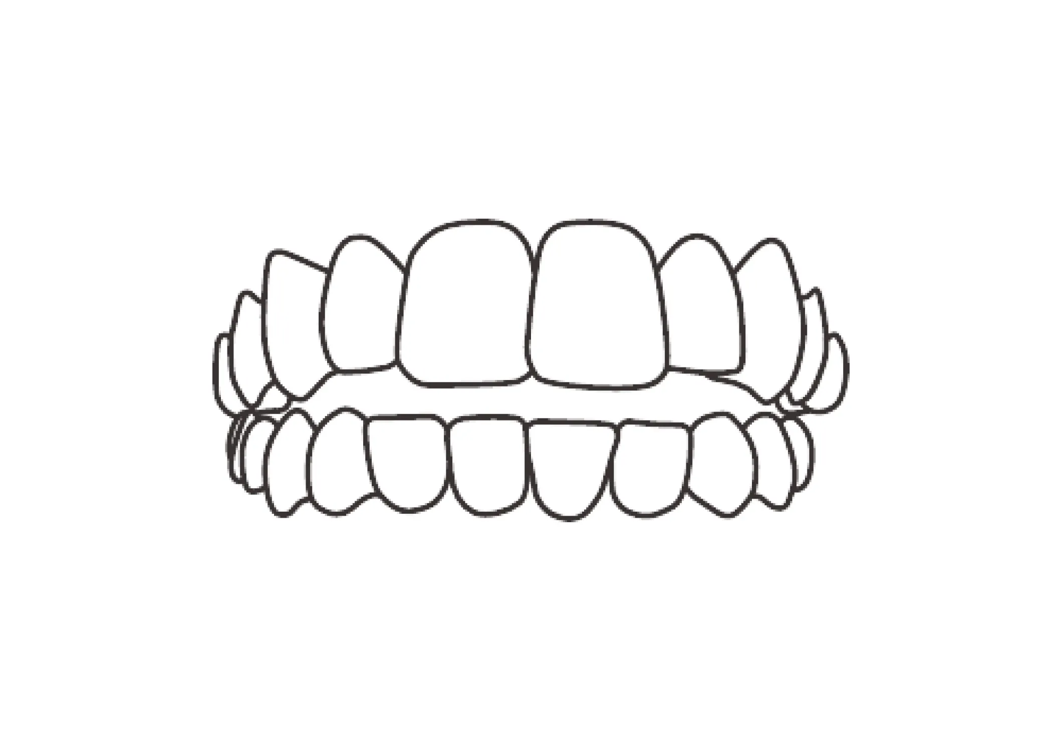 開咬（かいこう）