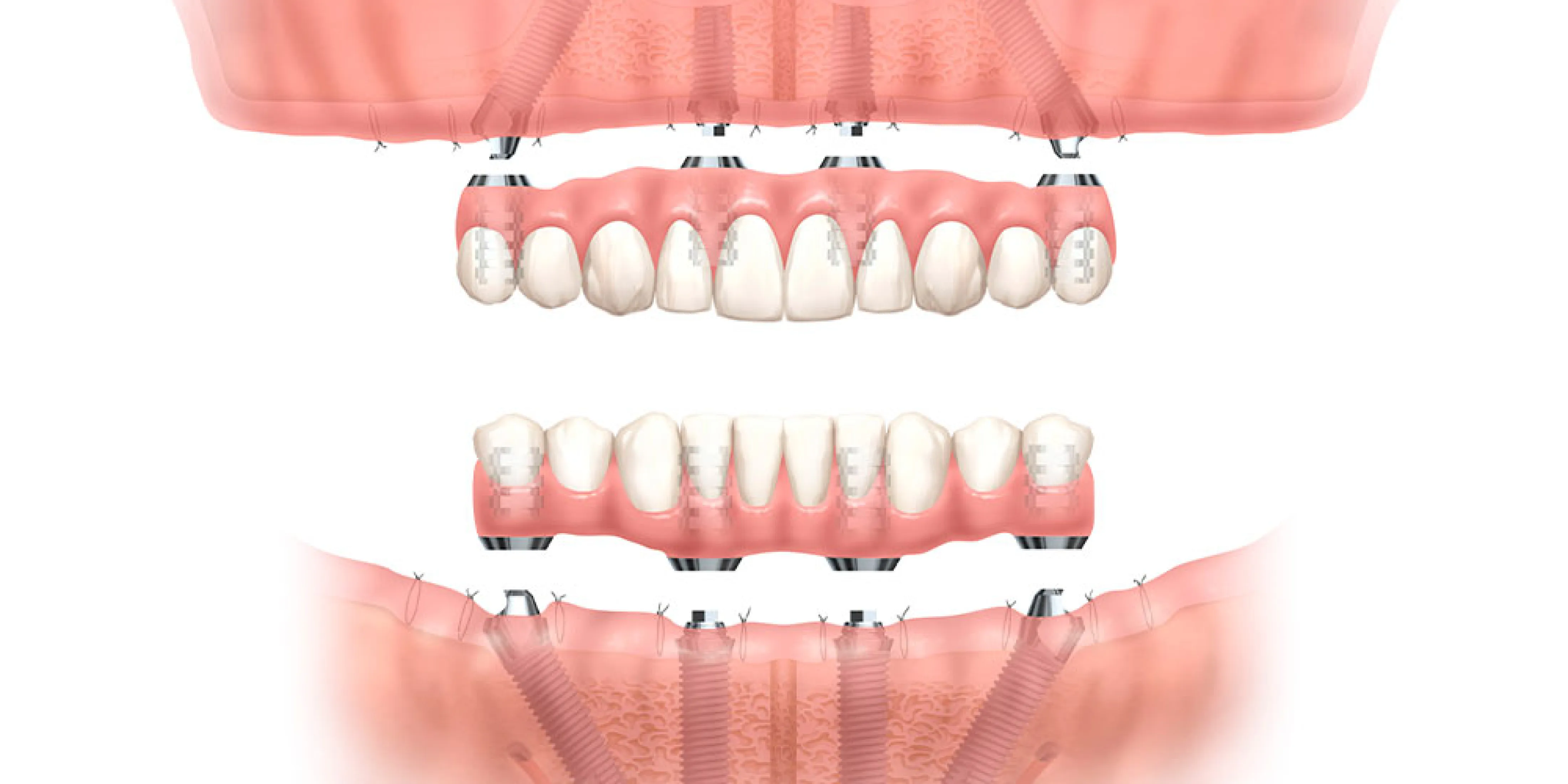ライフメディカル総合歯科クリニック八潮が大切にしている「歯を残す」ための対話