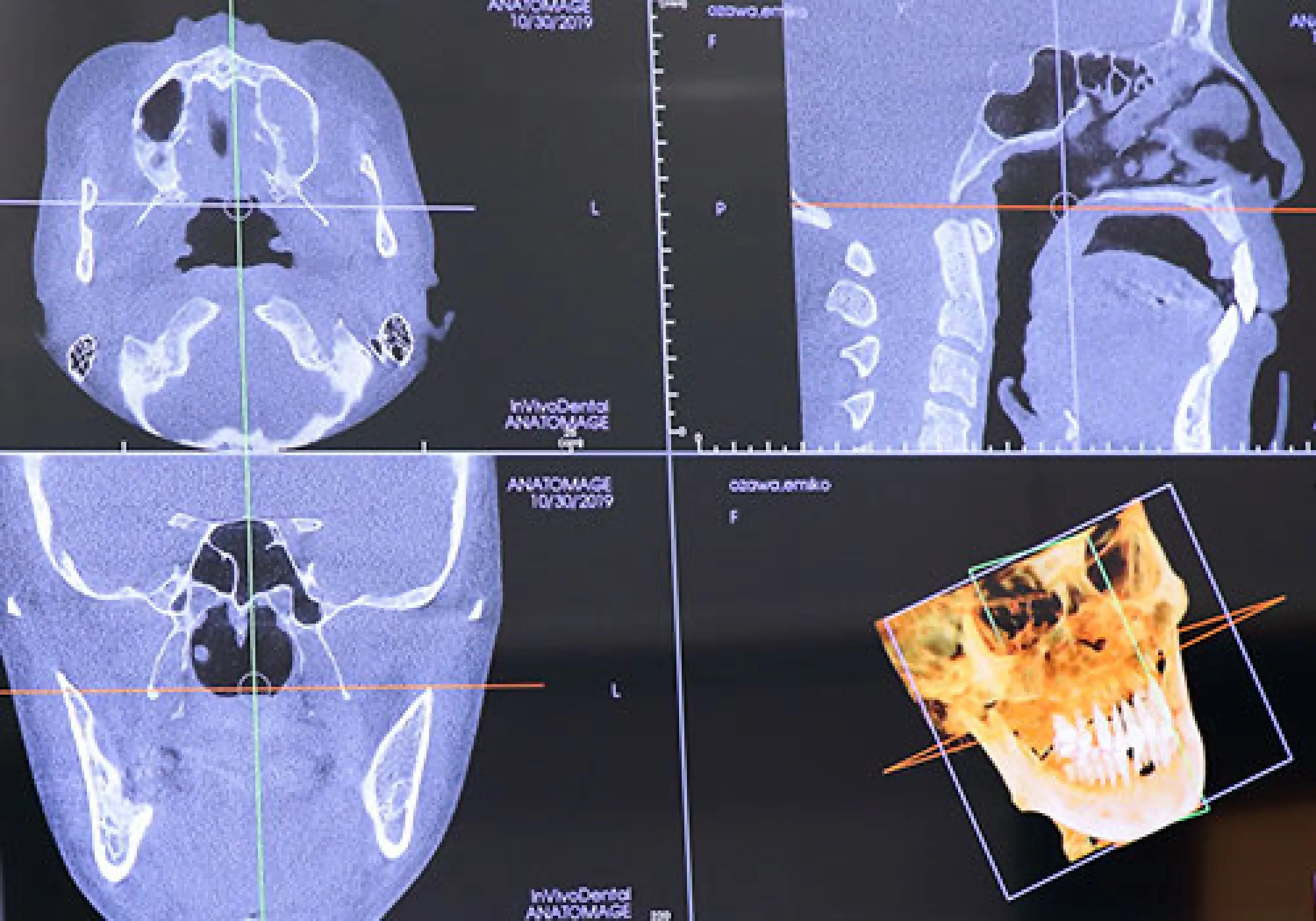 カウンセリング