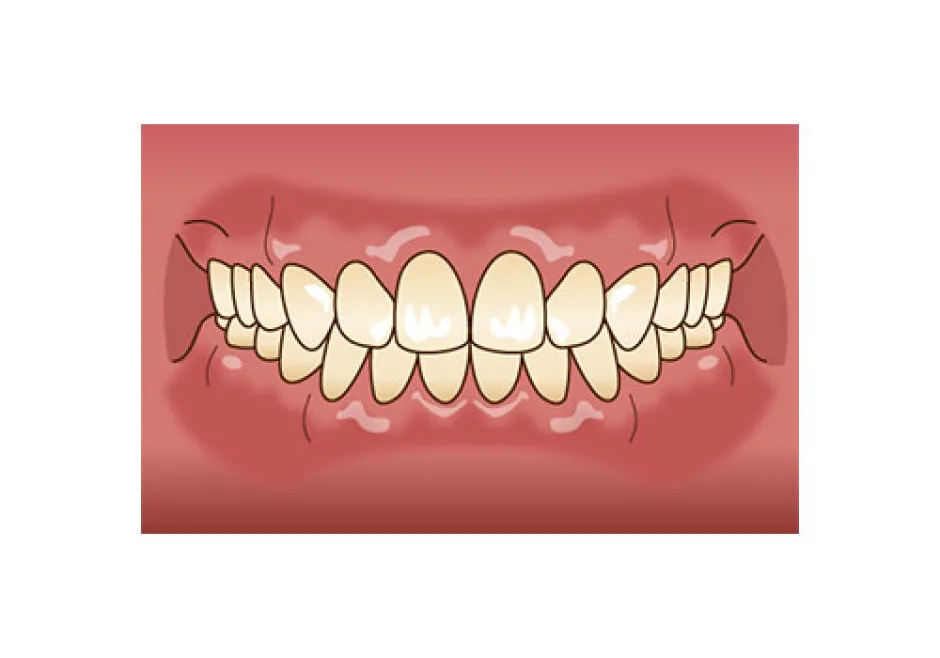 メインテナンス