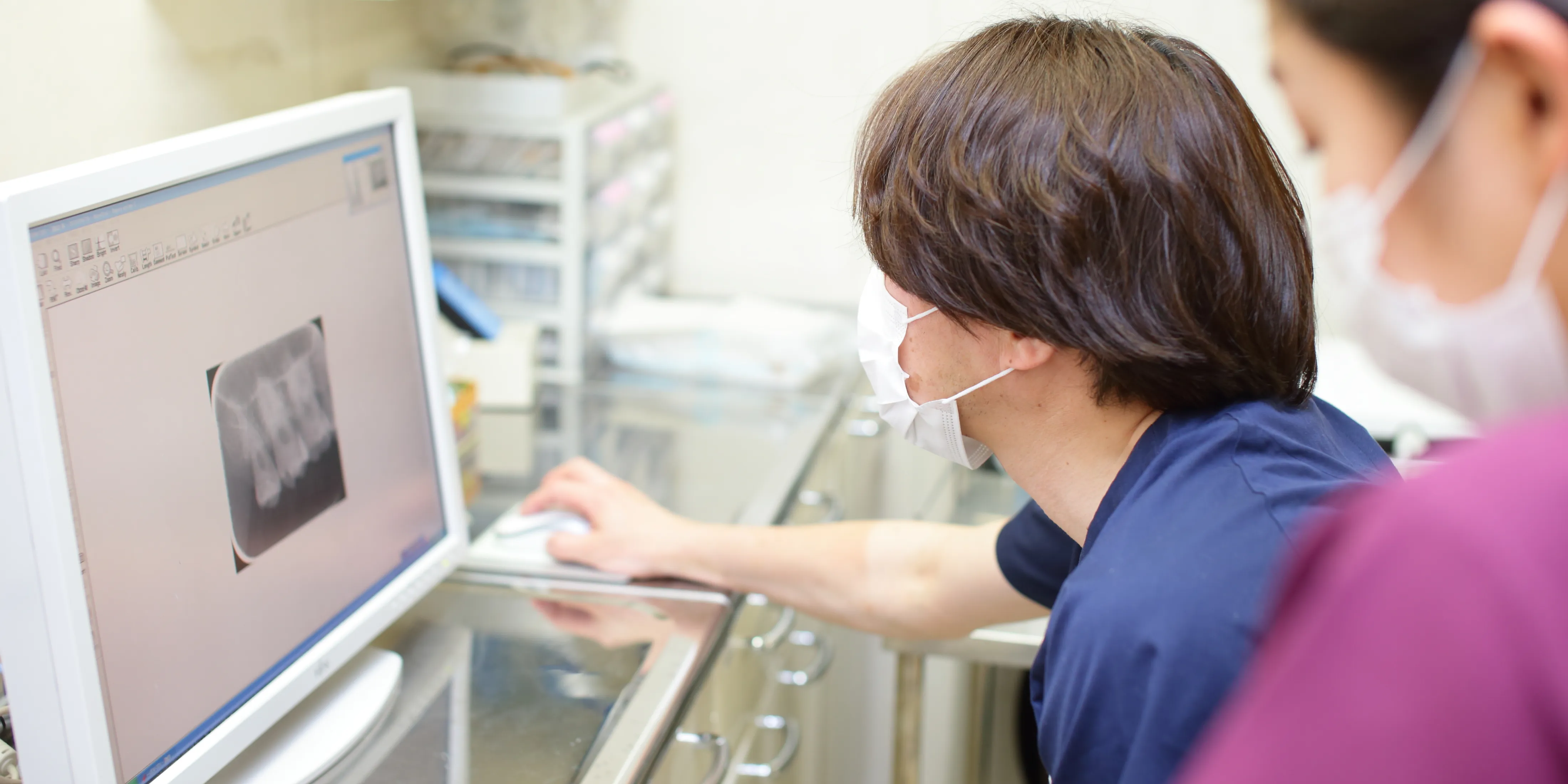 根管治療（歯の根の治療）について