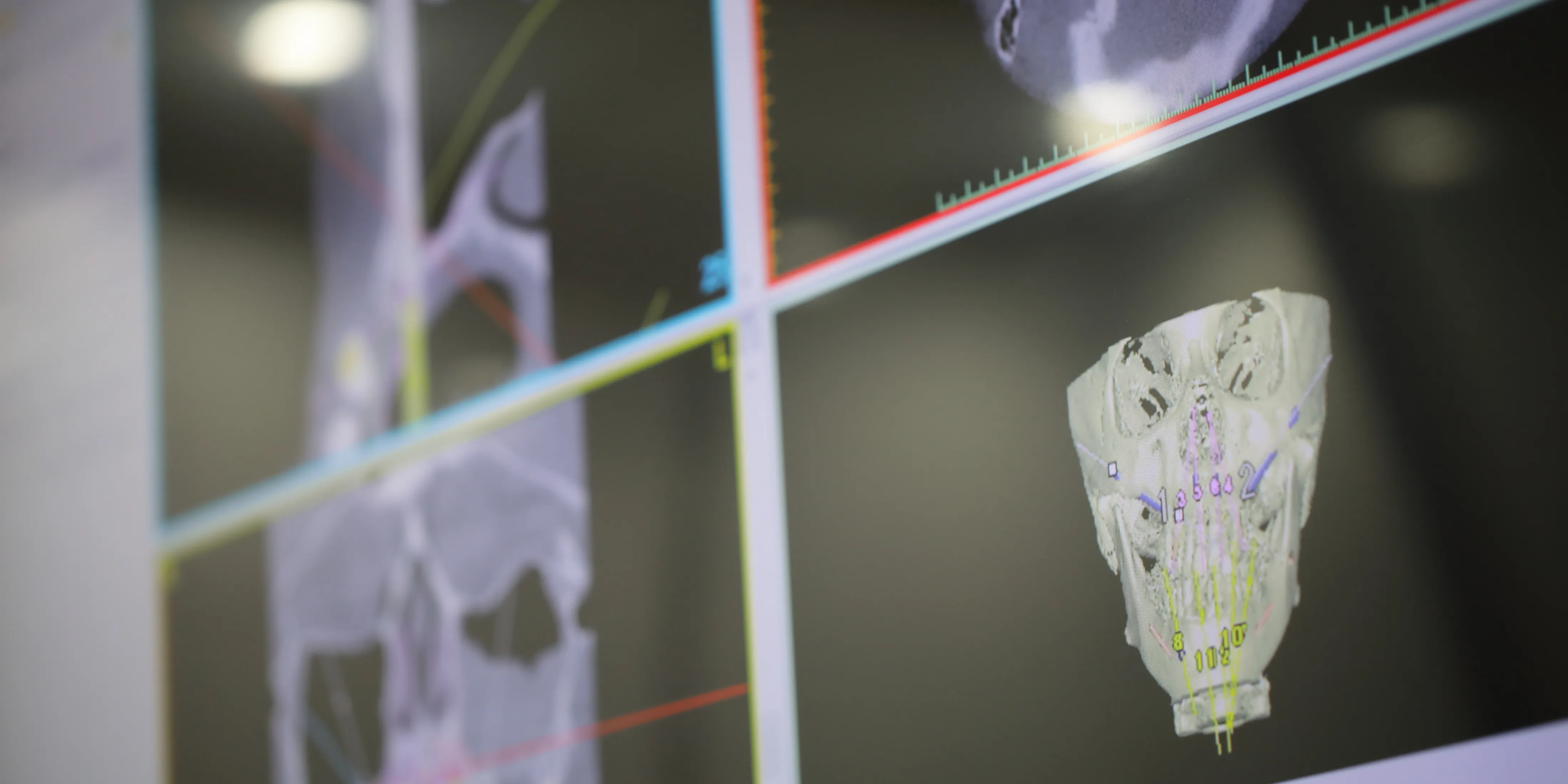 精密な根管治療を支える設備