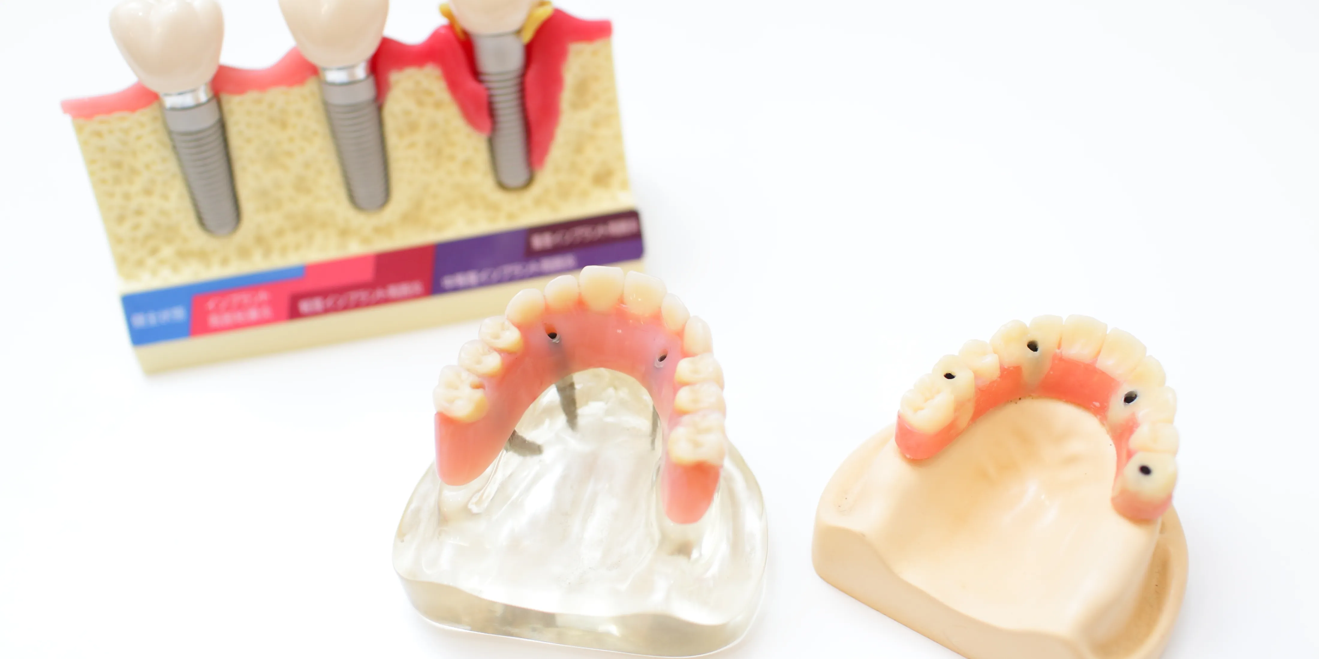 保険診療と自由診療（精密根管治療）の違い