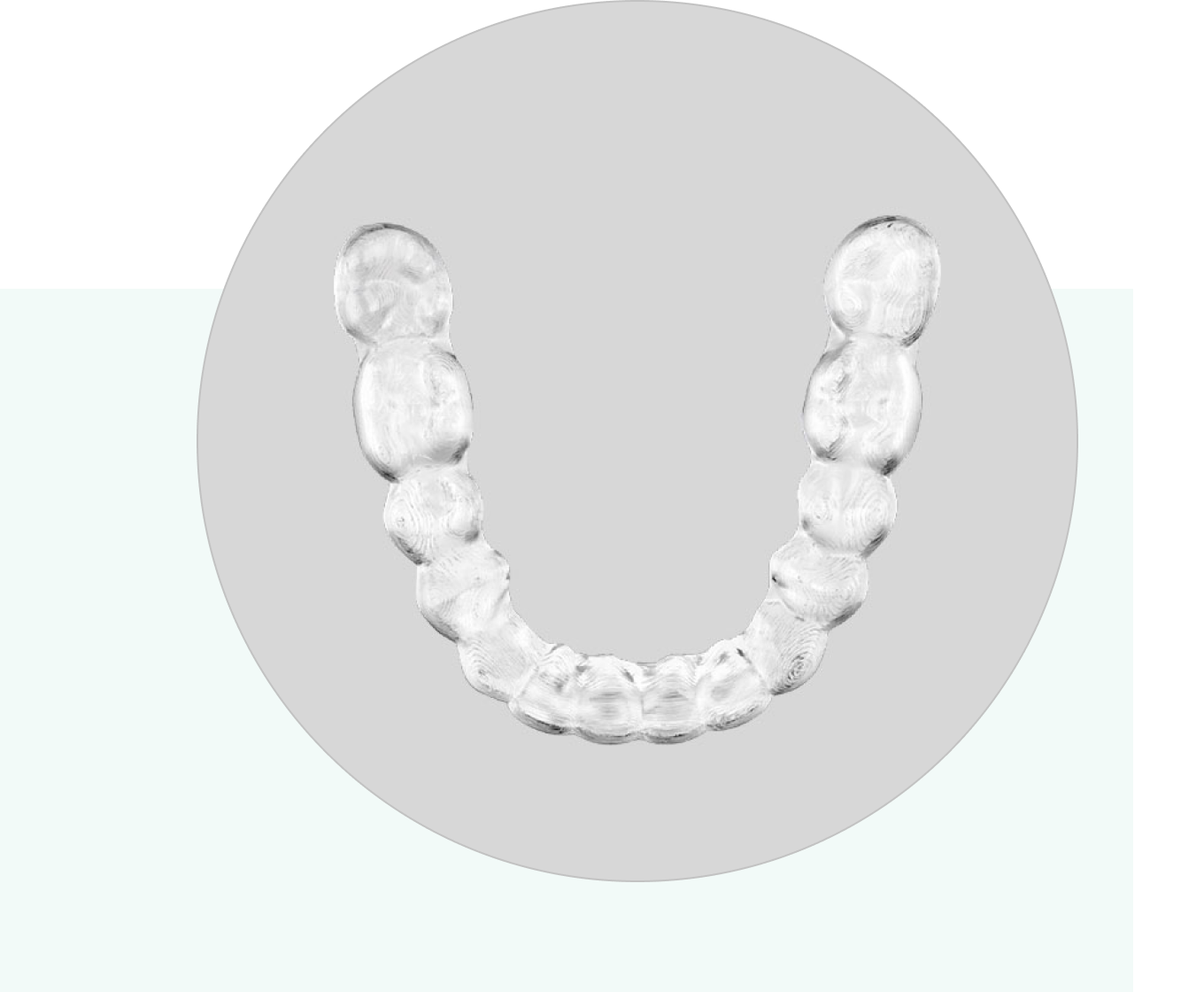 歯科用マウスピース