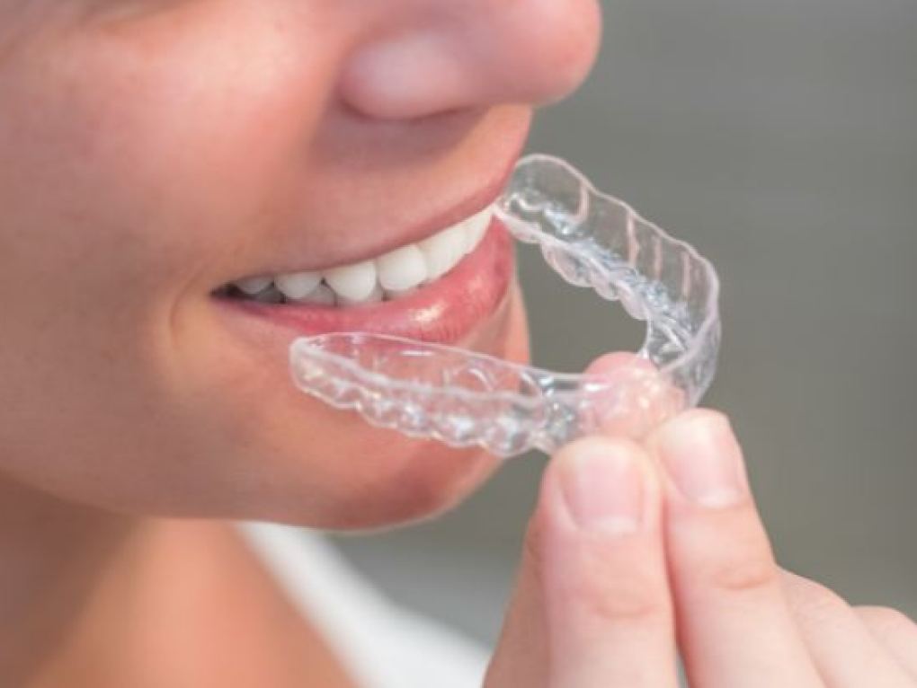 マウスピースをしようとしている様子