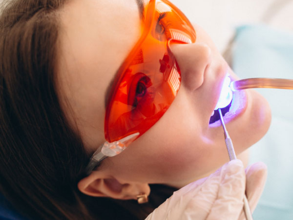 ホワイトニングをしている様子