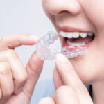 つくばエクスプレス沿線でマウスピース矯正するなら