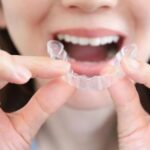 インビザライン、総額でいくら？つくばエクスプレス沿線の歯医者で比較