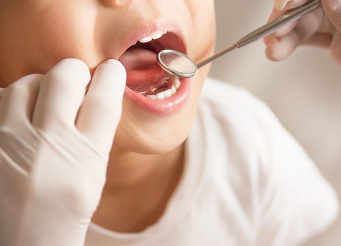 【歯医者が解説】小児矯正を始める「ベストな時期」はいつ？