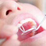 歯並びが気になる方へ！つくばエクスプレス沿線でマウスピース矯正