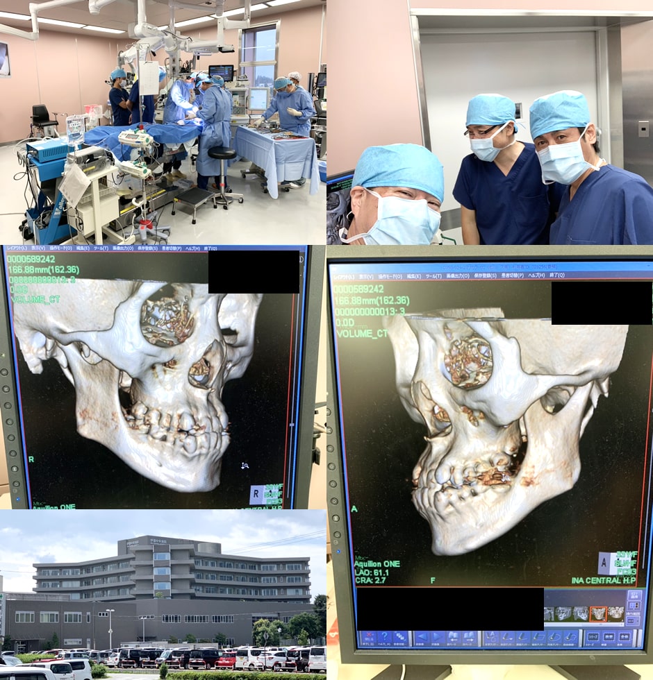 【2019.8.28】顎変形症のオペ