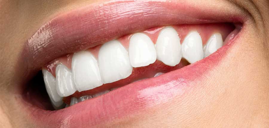 歯医者も驚く！保険適用で白い歯を長持ちさせる秘訣とは