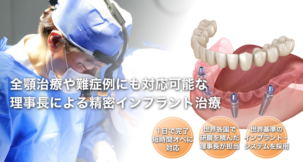 インプラント治療