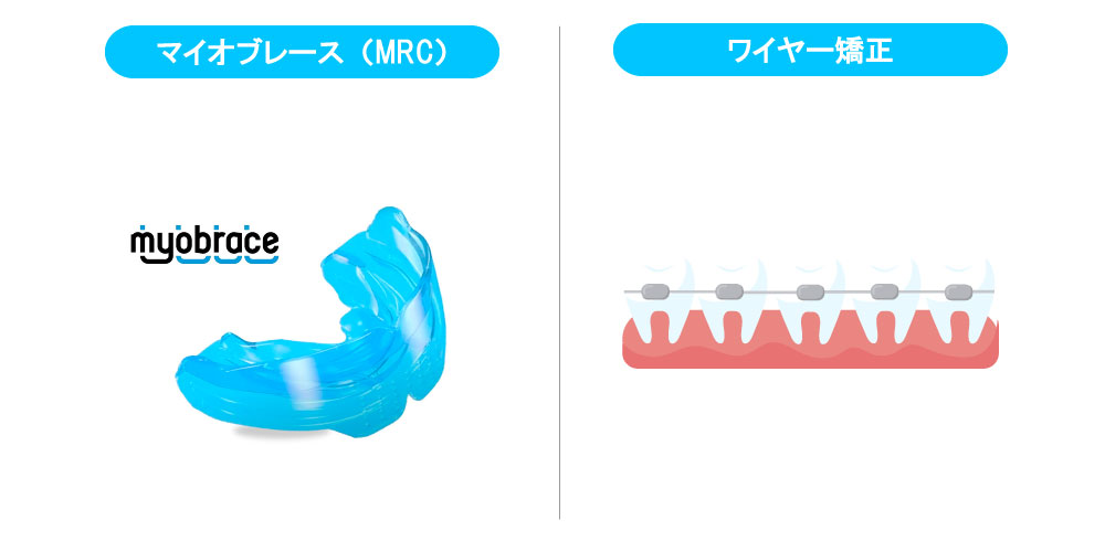 子供の矯正の種類