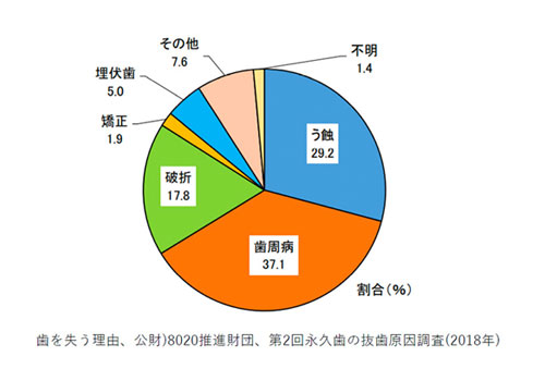 歯を失う原因